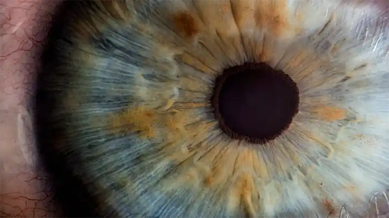 Closeup photo of an eye