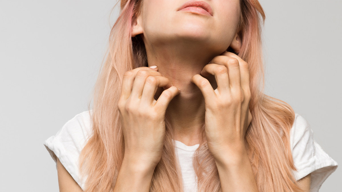 A woman with skin allergy scratching her neck