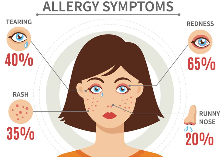 Allergy symptoms - tearing, rash, runny nose, redness