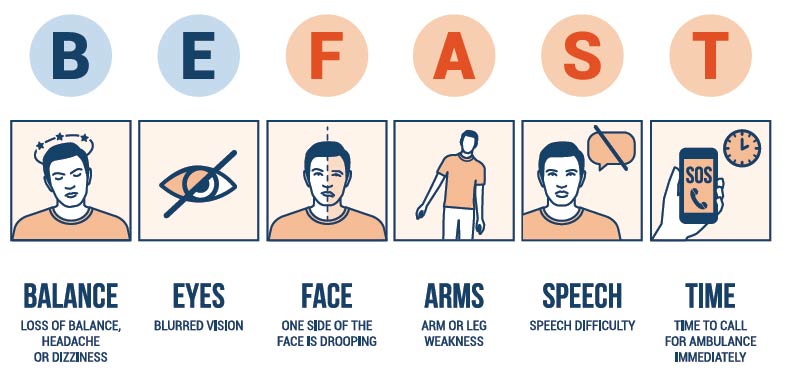 BE FAST to identify stroke and save a life. B.E.F.A.S.T. diagram graphic