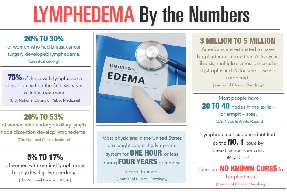 INFOGRAPHIC: Lymphedema by the Numbers