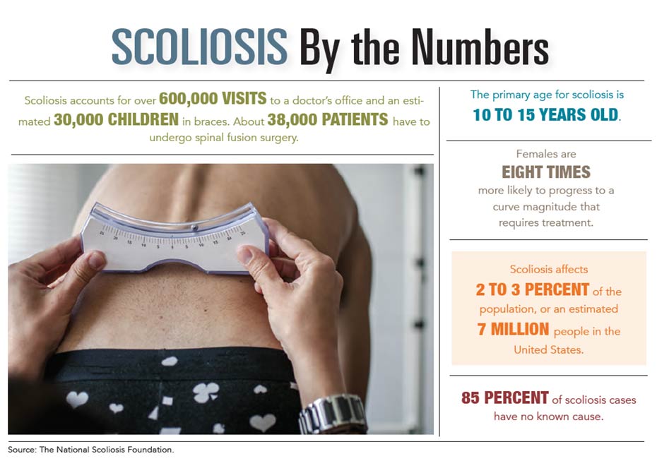 INFOGRAPHIC: Scoliosis by the Numbers