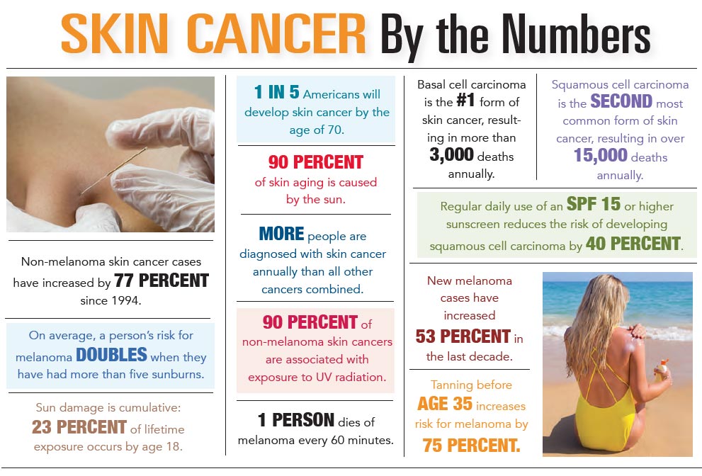 INFOGRAPHIC: Skin Cancer by the Numbers