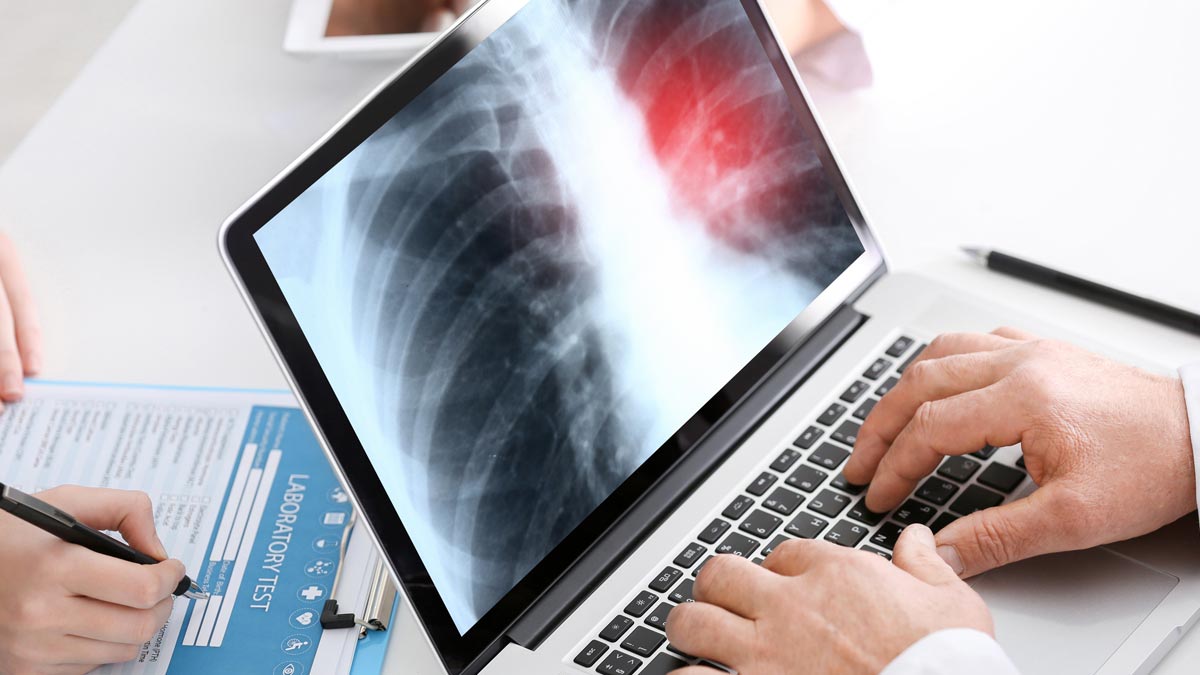 A doctor reviews a chest scan on a laptop computer