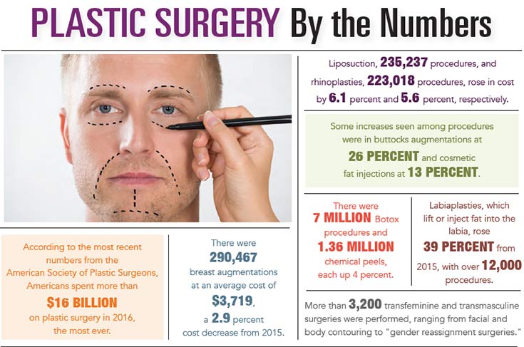 INFOGRAPHIC: Plastic Surgery by the Numbers