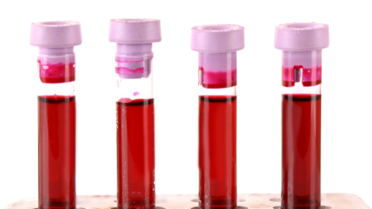 Blood testing vials. Blood Brain Barrier Permeability Test article