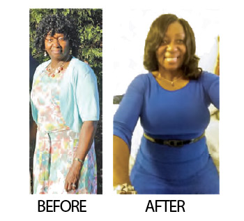 Deloris Washington before and after weight loss photos. If you change your lifestyle, the weight will stay off.