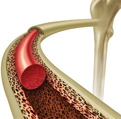 Bone Marrow Donoation