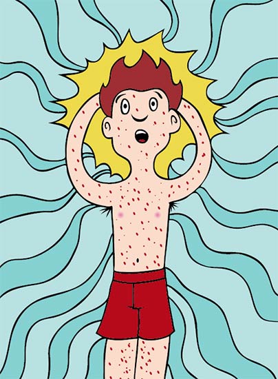 Not everyone who had chickenpox will get shingles. There is no clear way to tell when or if it will surface.