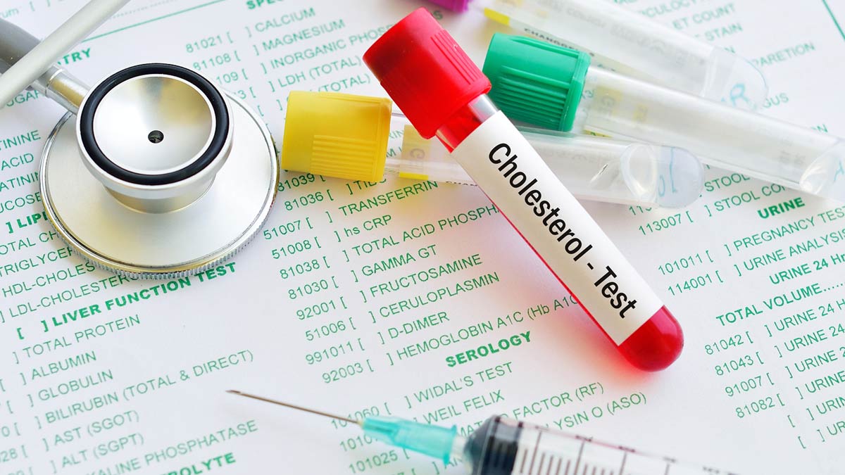 Cholesterol testing photograph for article 'Ways to Cut Cholesterol'