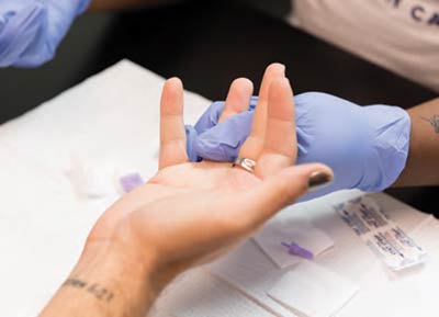 Photo of HIV blood test