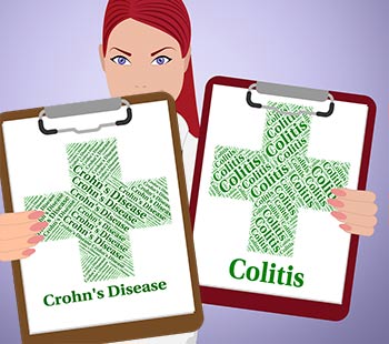 Inflammatory Bowel Disease: Crohn's Disease and Ulcerative Colitis