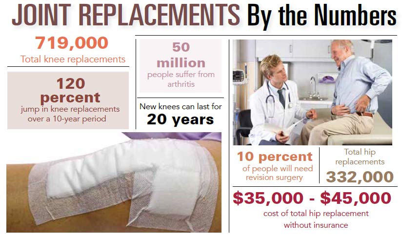 Joint Replacements By the Numbers