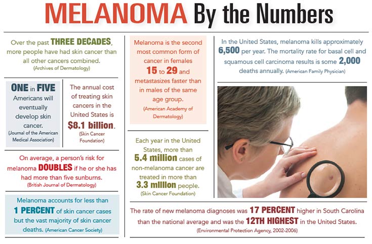 INFOGRAPHIC: Melanoma by the Numbers