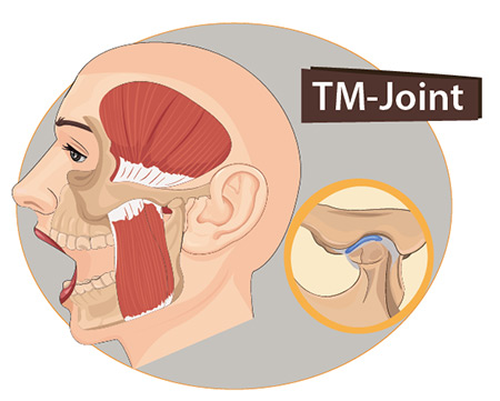 The TM Joint