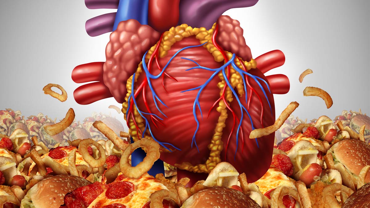 A graphic showing heart disease - a heart surrounded by pizza, burgers, onion rings and other heart-clogging foods