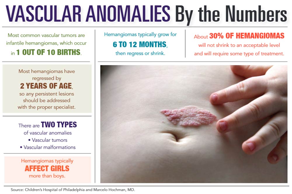 INFOGRAPHIC: Vascular Anomalies by the Numbers