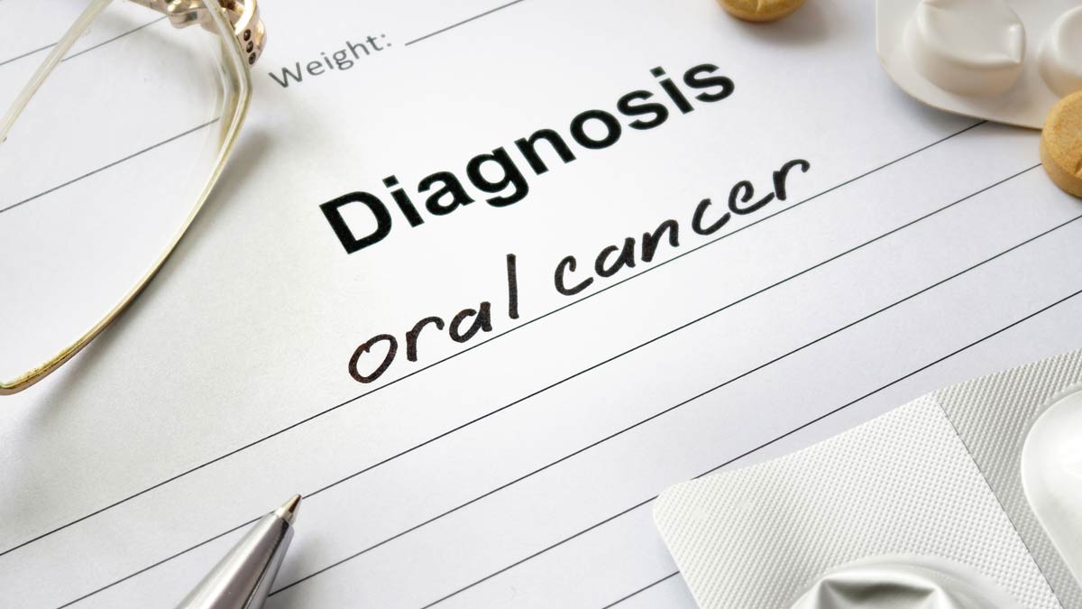 Oral cancer diagnosis