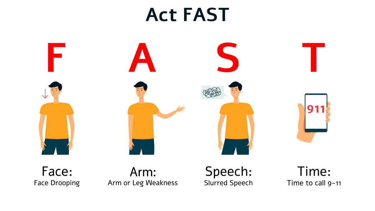 Act F.A.S.T. Stroke thumbnail image