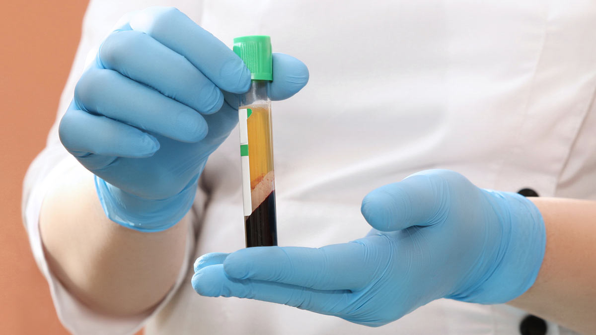 Nurse with a blood sample.