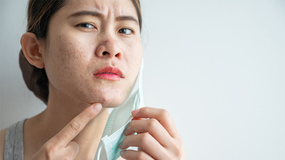 Photo of a woman noticing maskne, aka or mask acne.