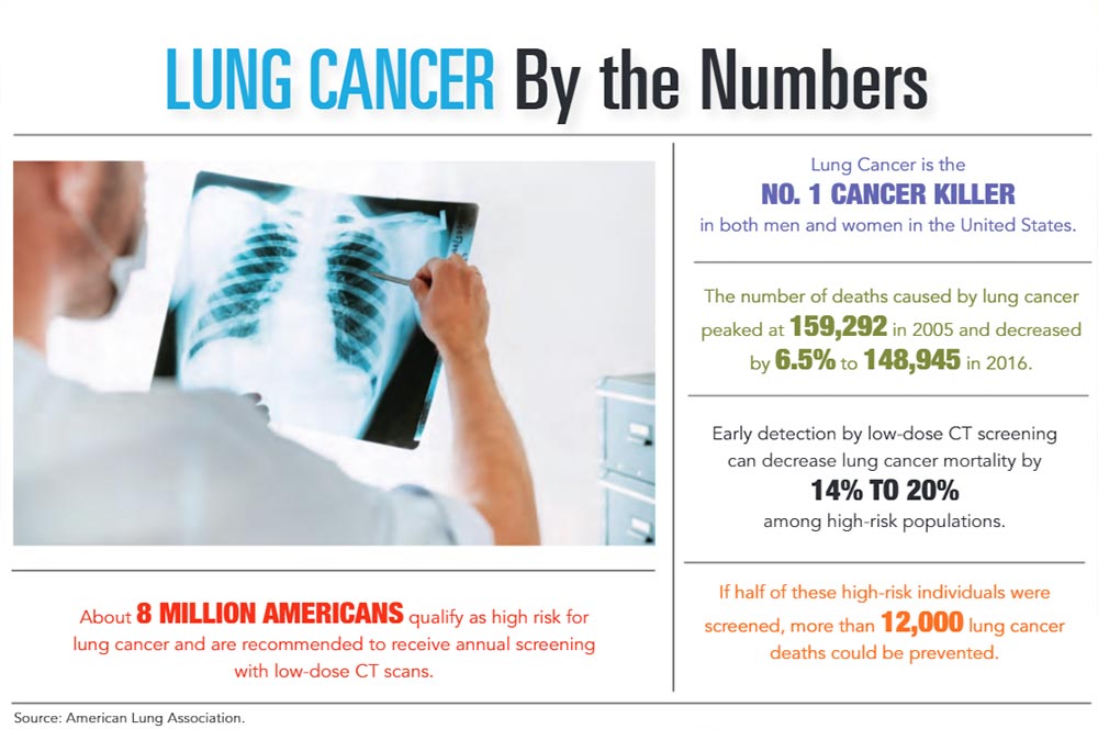 INFOGRAPHIC: Lung Cancer by the Numbers