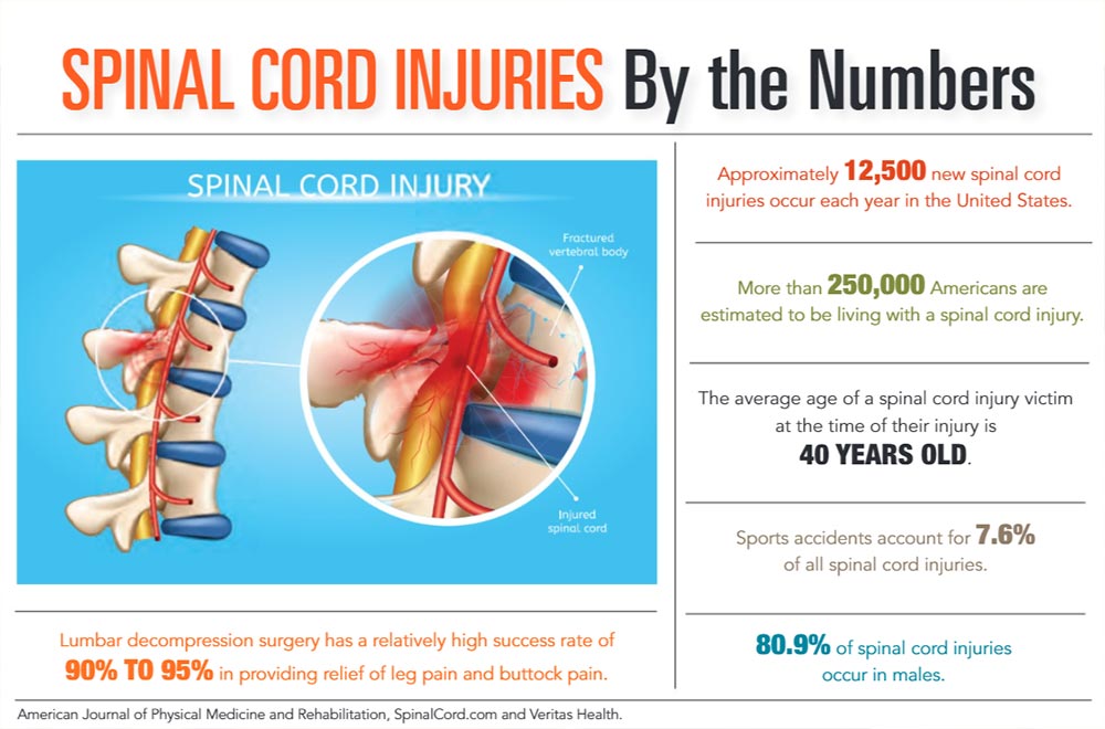 INFOGRAPHIC: Spinal Cord Injuries by the Numbers