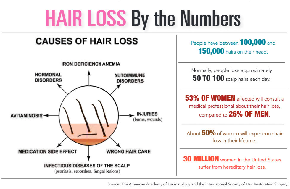 INFOGRAPHIC: Hair Loss by the Numbers