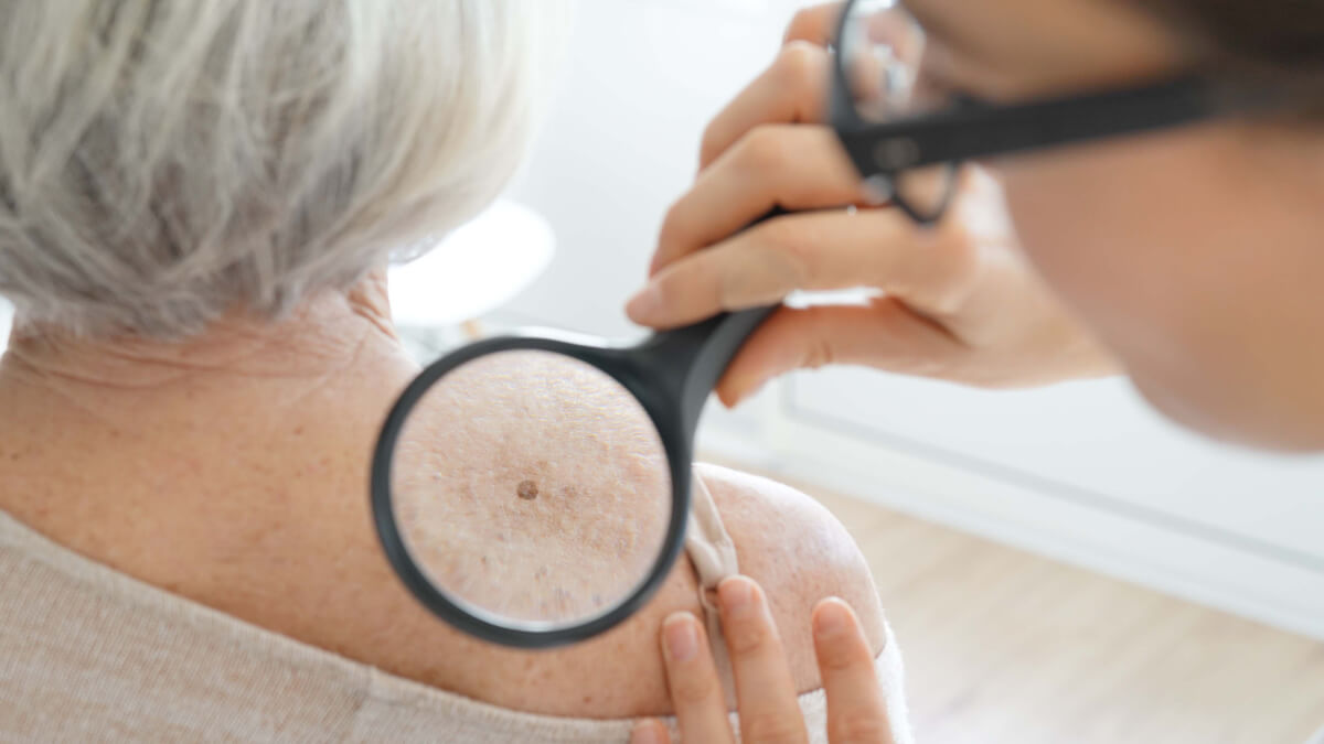 Dermatologist inspecting patient's skin at Trident Dermatology