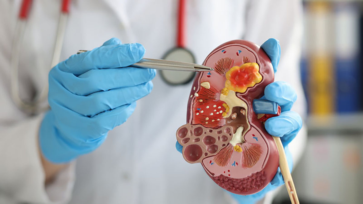 Photo of a doctor examining a kidney