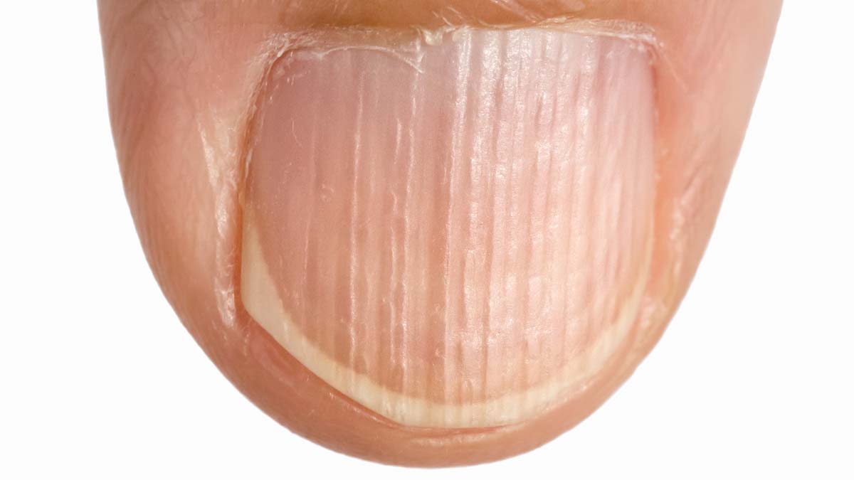 Photo of a nail