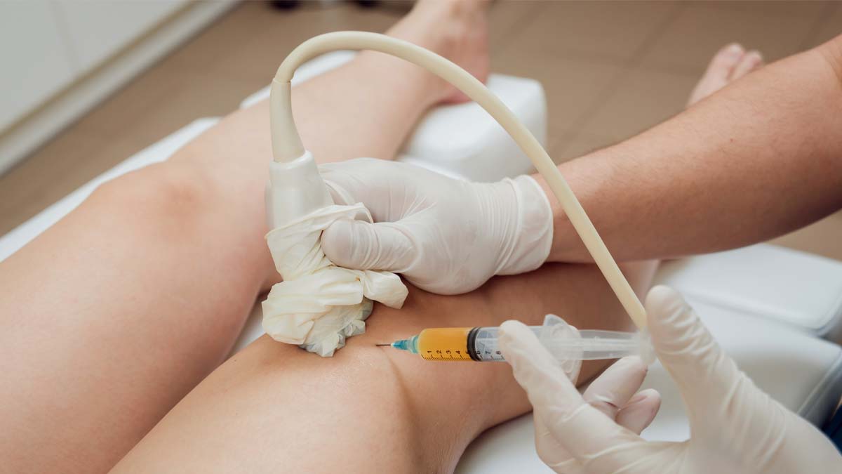 Photo of someone who is getting a needle and a machine on their leg