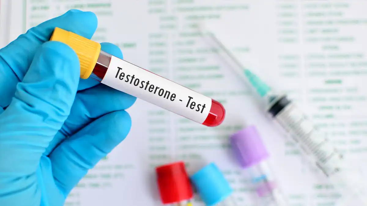 Photo of a test tube with a blood sample labeled 'Testosterone Test'